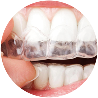 Clinica DF - Blog - Vantagens do Sistema Invisalign