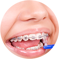 Clinica_DF_-_Blog_-_Higiene_e_aparelhos